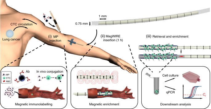 An Intravascular Magnetic Wire For The High Throughput Retrieval Of Circulating Tumour Cells In Vivo Nature Biomedical Engineering
