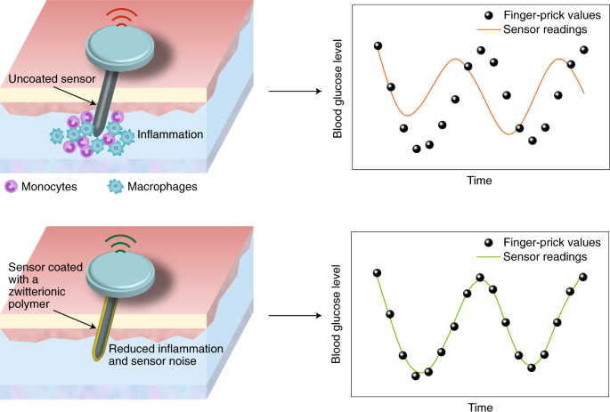 Coated glucose sensors dodge recalibration | Nature Biomedical Engineering