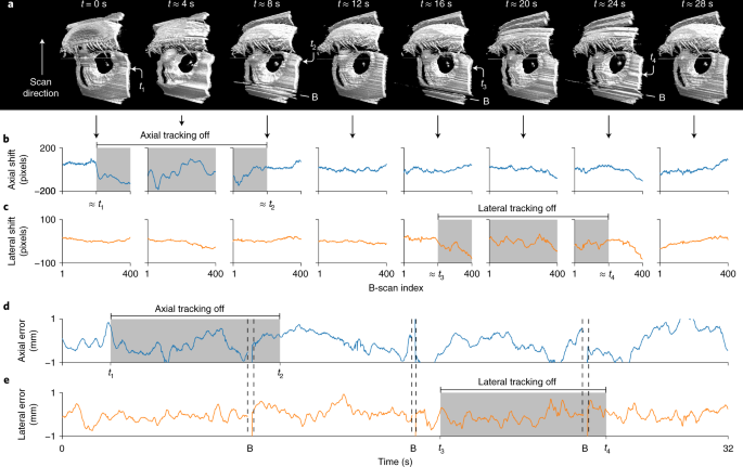 Contactless optical coherence tomography of the eyes of