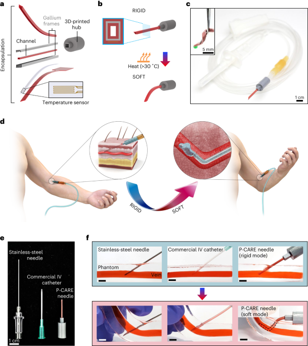 slight fever after iv glutathione Therapy Specialist in Orlando, FL Risks and side effects of