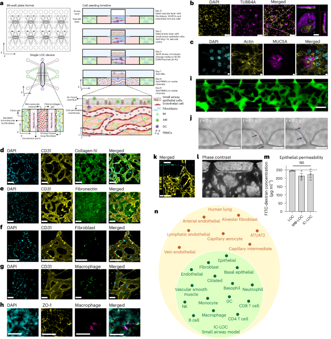 An immune-competent lung-on-a-chip for modelling the human severe influenza infection response