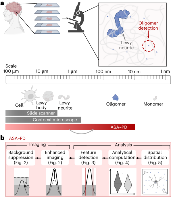 Large-scale visualization of α-synuclein oligomers in Parkinson’s disease brain tissue