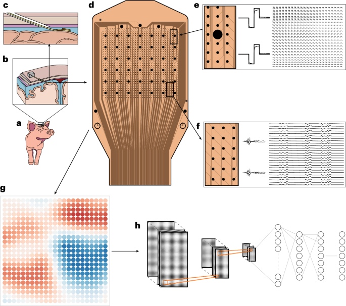 Minimally invasive implantation of scalable high-density cortical microelectrode arrays for multimodal neural decoding and stimulation