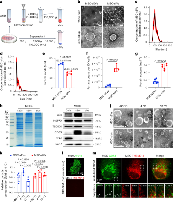 Small intracellular vesicles outperform small extracellular vesicles in uptake, drug delivery and retinal neuroprotection - Nature Biomedical Engineering