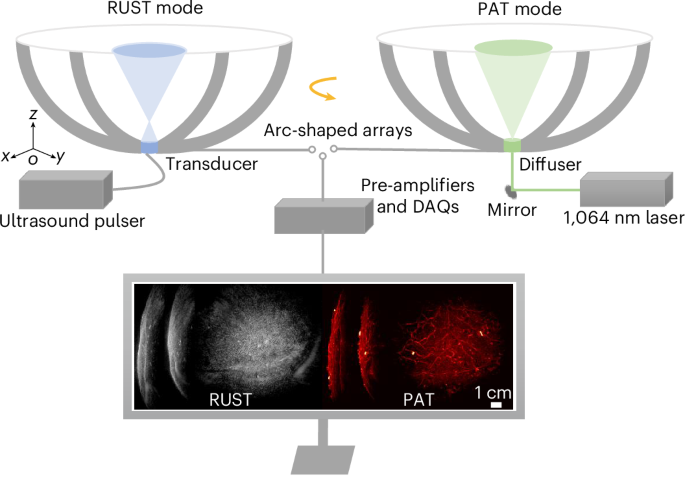 Rotational ultrasound and photoacoustic tomography of the human body - Nature Biomedical Engineering