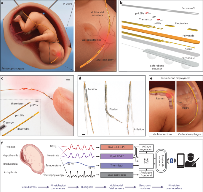 Image of the A filamentary soft robotic probe for multimodal in utero monitoring of fetal health - Nature news article