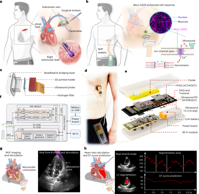 A wearable non-invasive sonogenetic pacemaker