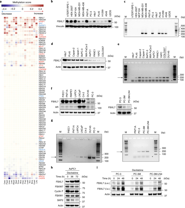 Epigenetic silencing of the ubiquitin ligase subunit fbxl7 impairs c-src degradation and promotes epithelial-to-mesenchymal transition and metastasis