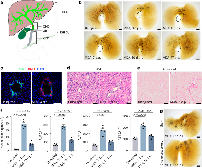 Gallbladder-derived retinoic acid signalling drives reconstruction of the damaged intrahepatic biliary ducts