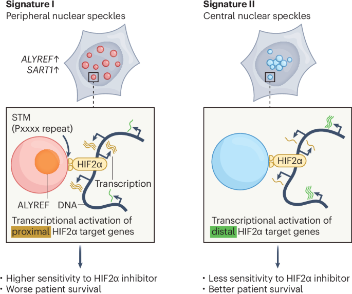 Speckle signatures dictate cancer prognosis