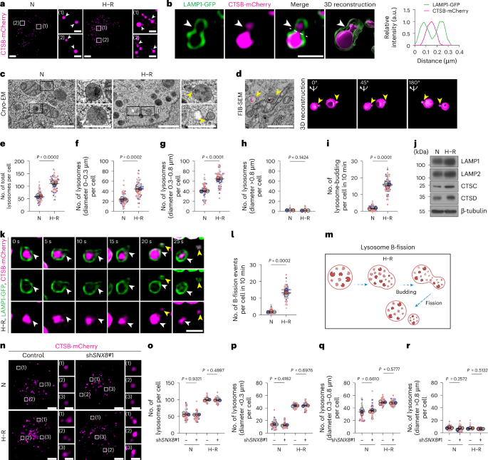 iam amazing white glutathione review Mitochondrial-derived vesicles drive budding-type fission of damaged lysosomes injection sites for bpc research peptides Color:5CF Light Brown Mocha