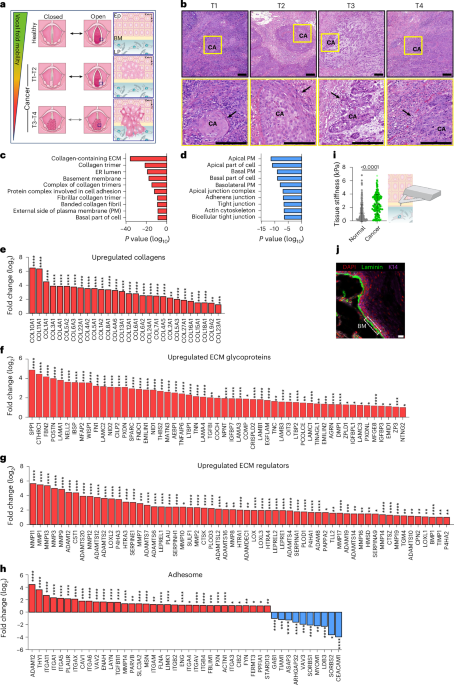 Restoring the tumour mechanophenotype of vocal fold cancer reverts its malignant properties