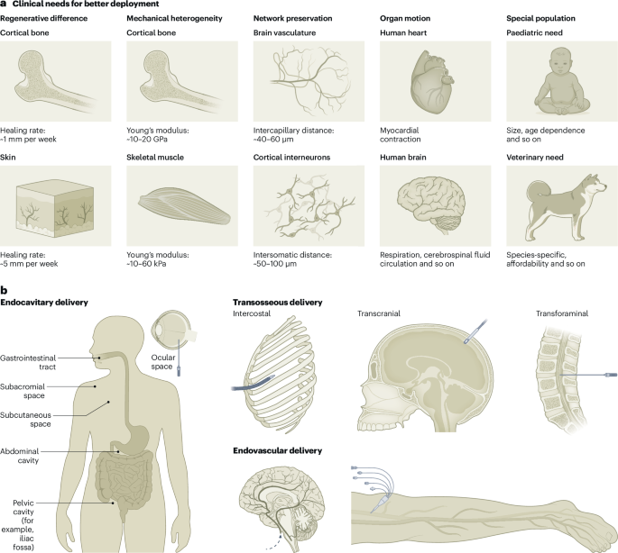 Minimally invasive bioelectronic implants