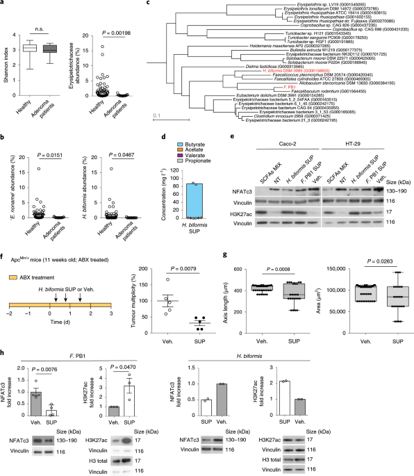 Sodium butyrate alleviates R97-116 peptide-induced myasthenia