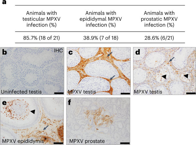 Monkeypox May Sometimes Spread Through the Air