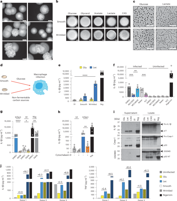 Candida auris uses nutrient sensing to modulate virulence and host immune responses - Nature Microbiology
