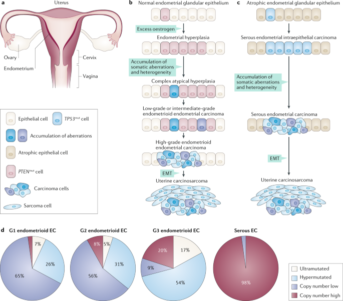 endometrium rák tumor markerek