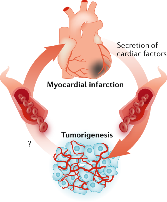 Can Heart Failure Cause Cancer Nature Reviews Cardiology