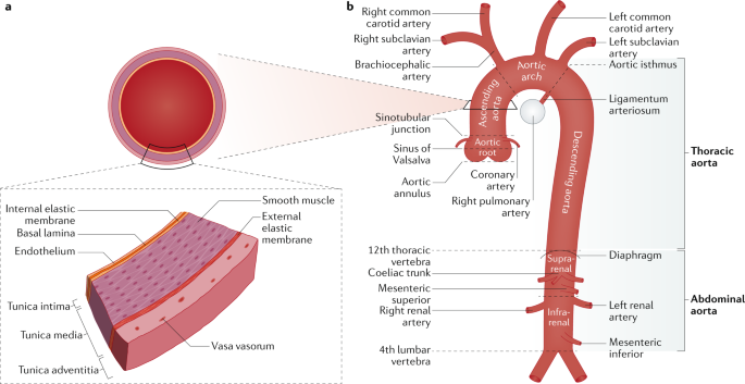 Epidemiology and management of aortic disease: aortic aneurysms and acute  aortic syndromes | Nature Reviews Cardiology