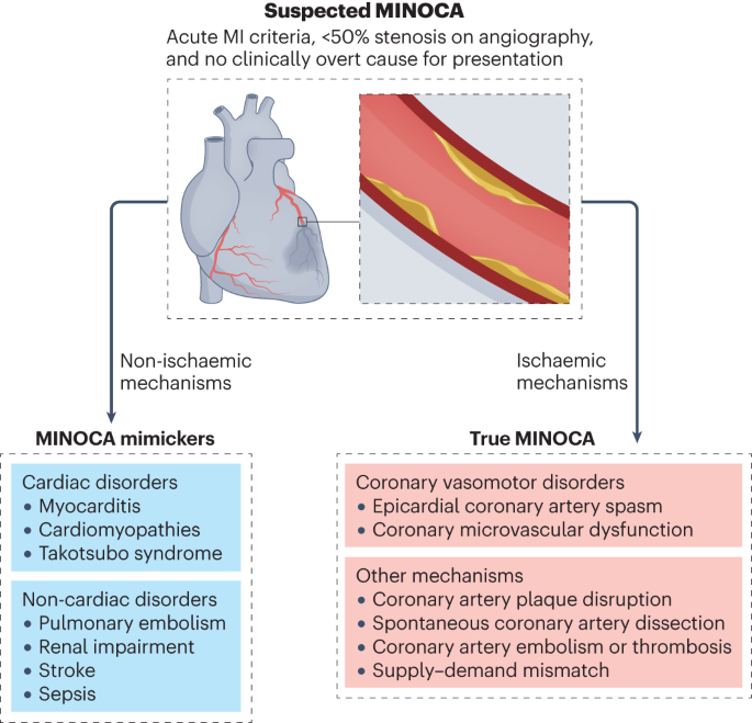 Sex-specific and ethnicity-specific differences in minoca