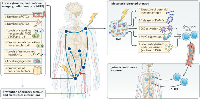 metastatic cancer prostate treatment