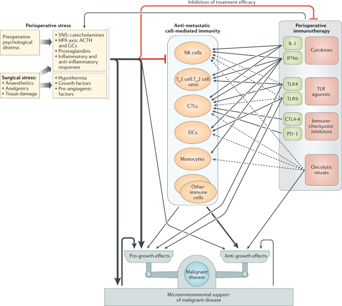 Harnessing cancer immunotherapy during the unexploited immediate perioperative period