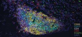 B cells and tlss facilitate a response to ici