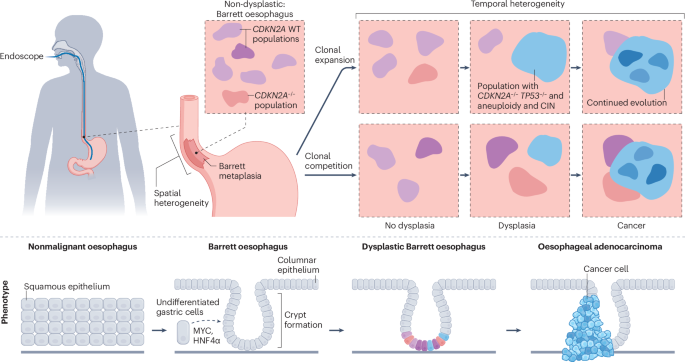 The biology and therapeutic implications of heterogeneity in Barrett oesophagus and oesophageal adenocarcinoma - Nature Reviews Clinical Oncology