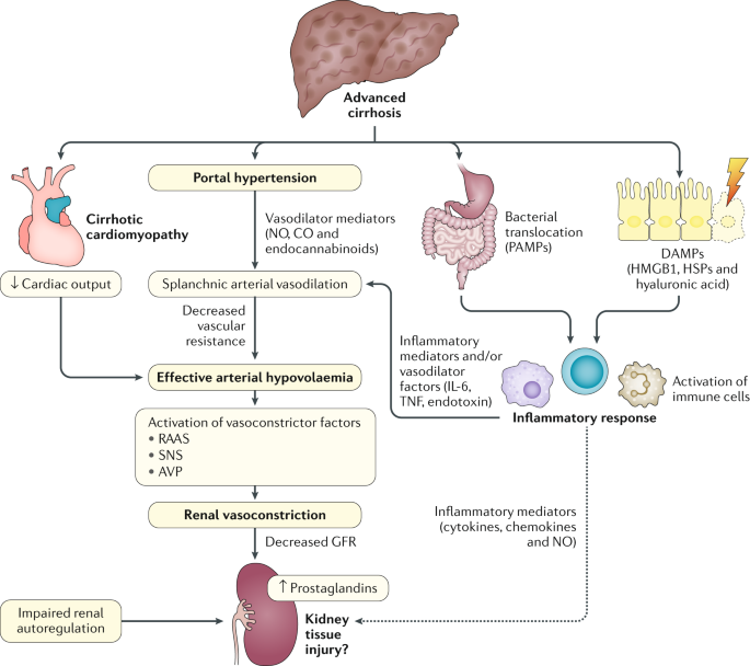 Hepatorenal syndrome | Nature Reviews Disease Primers