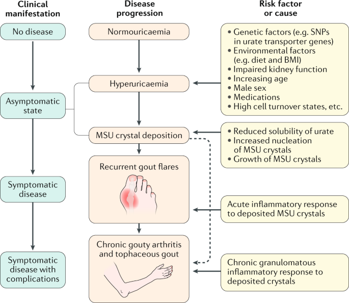 Gout  Nature Reviews Disease Primers