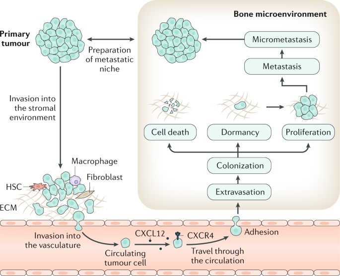 Treating the Complications of Bone Metastases
