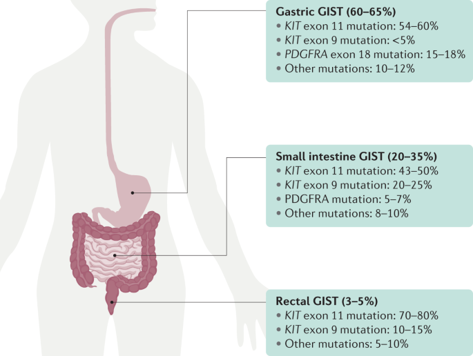 Gastrointestinal stromal tumours | Nature Reviews Disease Primers