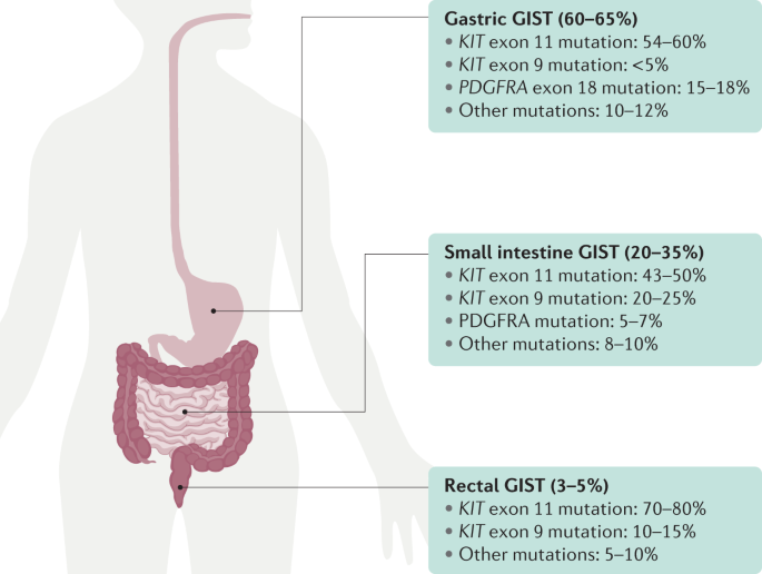 Gastrointestinal Stromal Tumours | Nature Reviews Disease Primers
