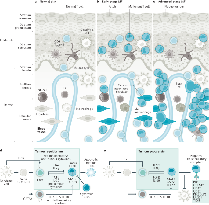 phototherapy for t cell lymphoma