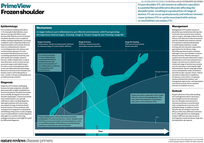 Frozen shoulder | Nature Reviews Disease Primers