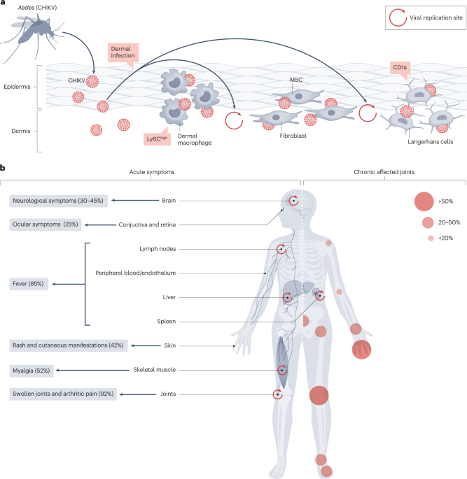 Chikungunya fever  Nature Reviews Disease Primers