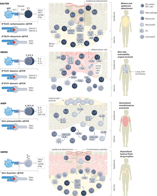 Severe cutaneous adverse reactions | Nature Reviews Disease Primers