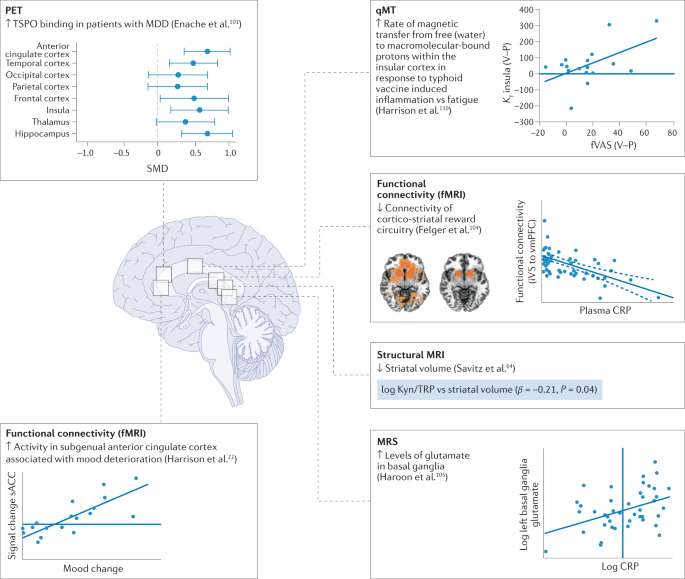 Aiding and Abetting Anhedonia: Impact of Inflammation on the Brain and  Pharmacological Implications