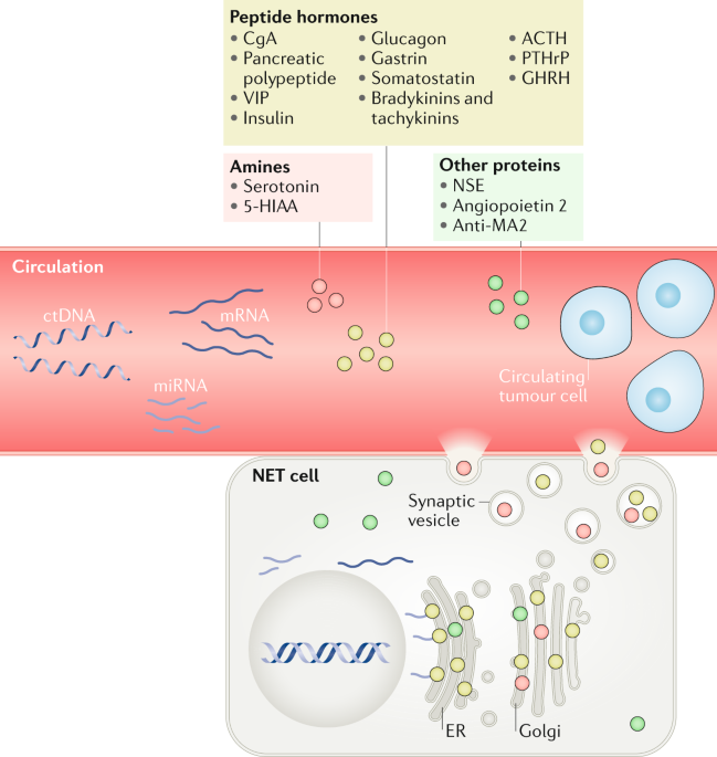 neuroendocrine cancer means giardioza cand este insarcinata