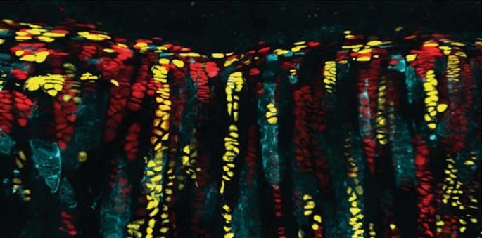 What makes bones grow? | Nature Reviews Endocrinology