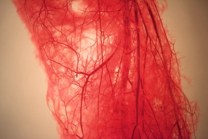 Diagnosing diabetes mellitus from smartphone-based vascular signals