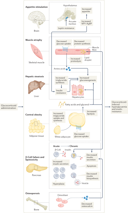 steroids and glp 1 Fresh insights into glucocorticoid-induced diabetes mellitus and new  therapeutic directions