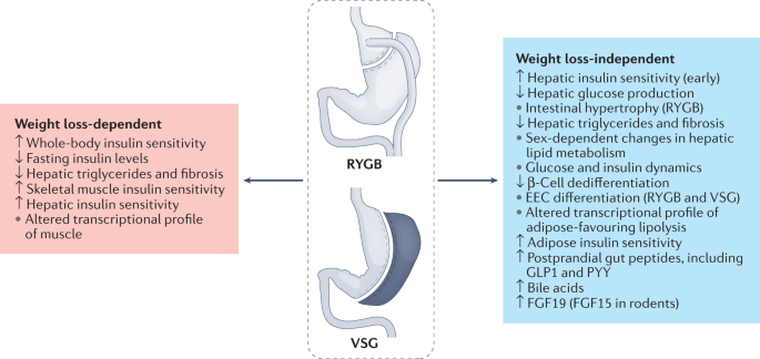 Glucose metabolism after bariatric surgery: implications for T2DM 