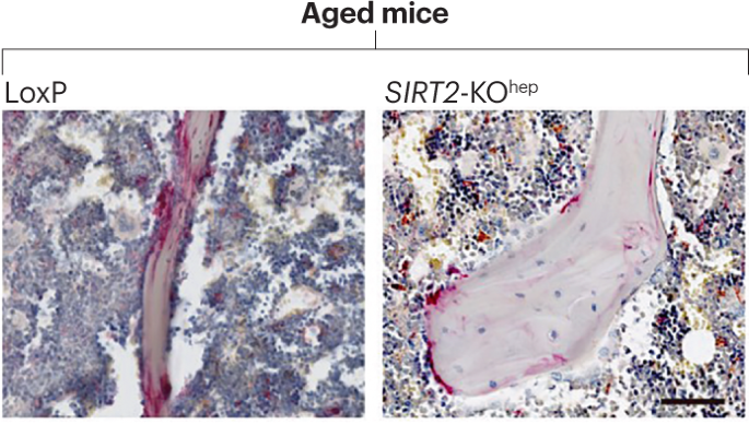 Liver–bone crosstalk implicated in osteoporosis progression