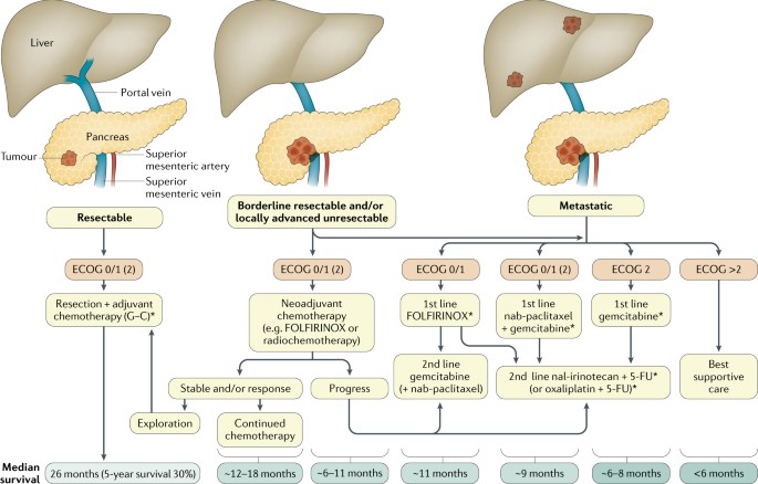 pancreatic cancer treatment options)