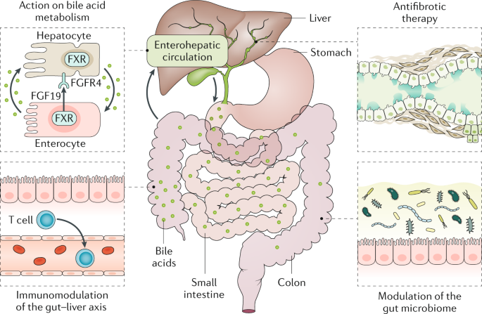 Better end points needed in primary sclerosing cholangitis trials