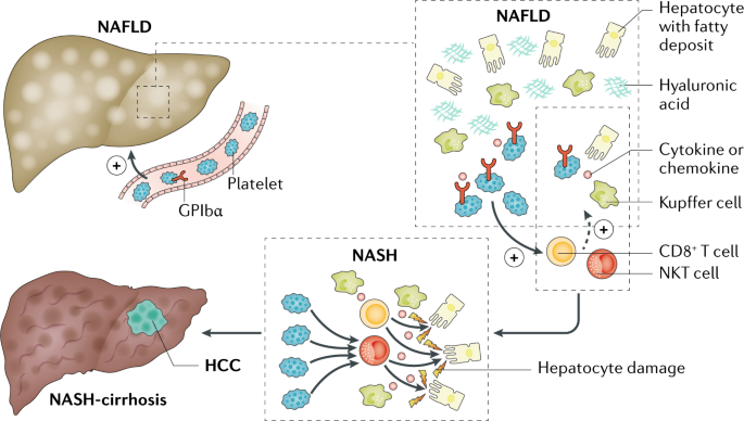 The effects of platelet accumulation in fatty liver disease | Nature Reviews  Gastroenterology & Hepatology