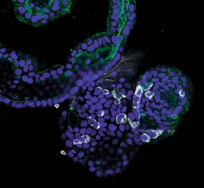 Intero Biosystems ships living mini-intestines to replace animal testing