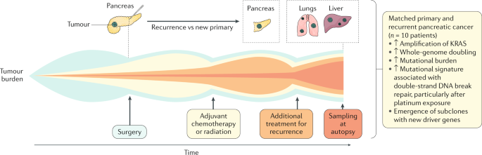how to treat pancreatic cancer