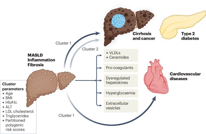 Clusters of metabolic dysfunction-associated steatotic liver disease ...